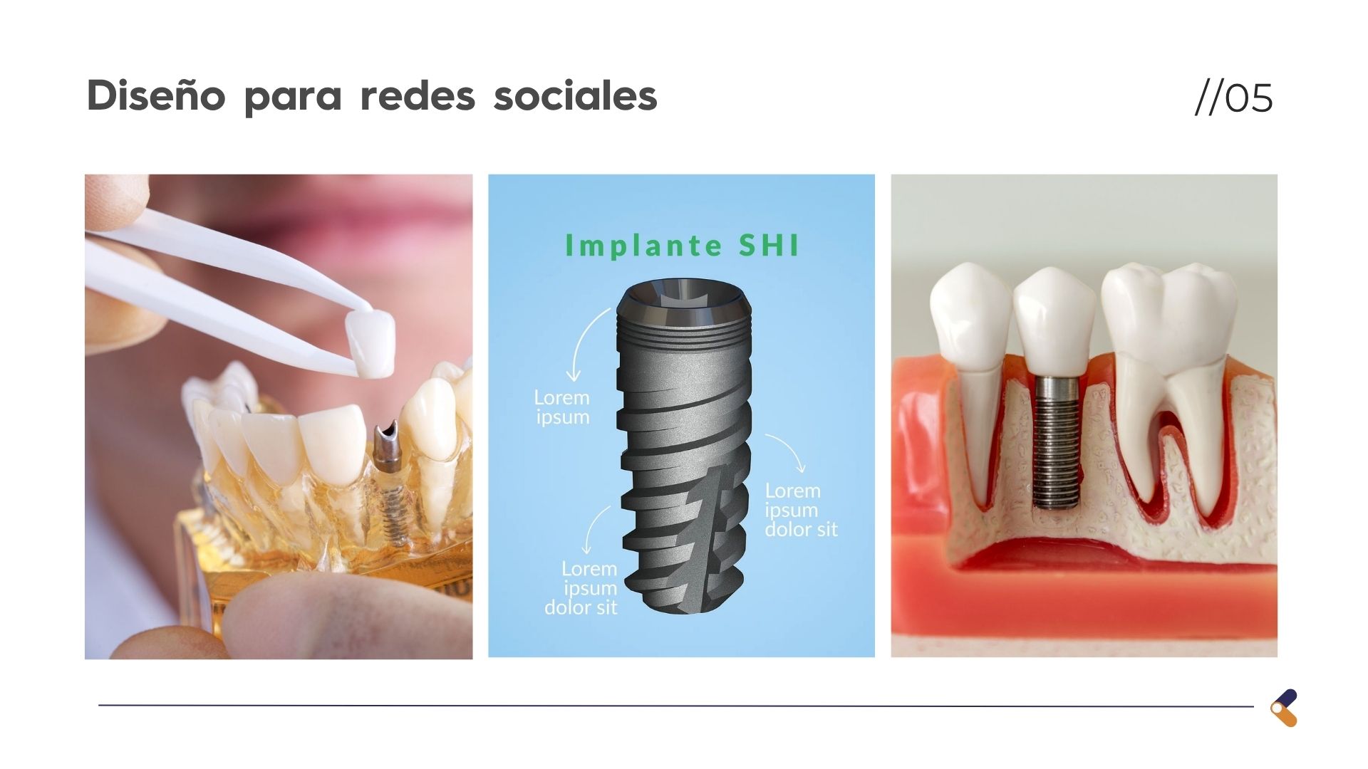 Línea de diseño - ML Implant System SEPTIEMBRE (1)