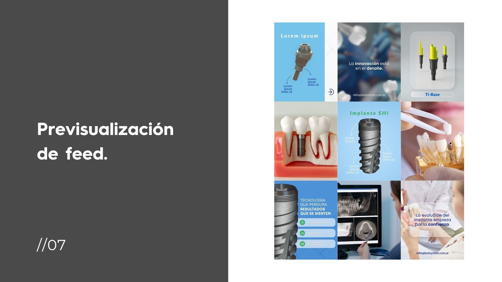 Línea de diseño - ML Implant System SEPTIEMBRE